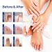Nail Fungal Treatment Spray - Advanced Toenail & Nail Strengthener Repair - 10ml - Buy Online on GoSupps.com