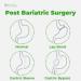 BariSlim Bariatric Calcium Citrate Plus Powder - 600 mg (30 Servings) | Bone Health Support After Weight Loss Surgery - Buy Online on GoSupps.com