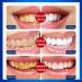 28-Pack Teeth Whitening Strips & Tooth Silk - Mint Flavor Stain Remover Kit - Buy Online on GoSupps.com