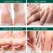 Cracked Feet Cream - Moisturizing Hand Cream 42% With 3.5 oz Cream for Men That Remove Dead Skin from Foot Calluses - Buy Online on GoSupps.com
