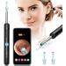 Ear Wax Removal with Camera  Wireless Ear Cleaner Tool Kit  1080P FHD Ear Endoscope Otoscope with 6 LED Light  Spade Earwax Removal Ear Cleaning Kit for iPhone  iPad & Android Smart Phones (Black)