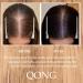 Qong Hair Oil - Rosemary Oil for Hair Growth | Natural Growth Oil for Thinning Hair | 30ml Suitable for All Hair Types - Buy Online on GoSupps.com
