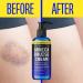 iQ Natural Arnica Cream - Extra Strength Bruise Gel for Fast Healing - 4oz - Buy Online on GoSupps.com