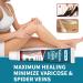  MagiSel Varicose Vein Cream Spider Leg Repair Cream Vein Soothing Cream Relieves Tired and Heavy Legs Soothes and Moisturizes 20g - Buy Online on GoSupps.com