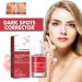 Trendyfave Dark Spot Serum Niacinamide Serum Brightening Serum 10% Niacinamide+ 4% Tranexamic Acid Dark Spot Corrector For Face Age Spot Remover For Face Face Redness Remover Arbutin Serum - Buy Online on GoSupps.com
