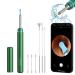 BEBIRD M9 Pro Ear Wax Removal Tool Ear Camera with 6 LED Lights 1080P Ear Scope Ear Cleaner for Adults and Kids Ear Pick with Silicone Replacement Soft Ear Scoops for Earwax Cleaning (Green)