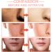 30% Vitamin C Serum for Face Skincare with 10% Hyaluronic Acid &Vitamin E 5 in 1 Facial Serum Hyaluronic Acid 10% For Face Hydrated Anti Aging Facial Brightening Serum for All Skin Types - Buy Online on GoSupps.com