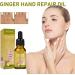Oil Hand Fine Finger Firming Oil - Delicate Whitening & Anti-Aging Massage Oil 30ml | International Shipping - Buy Online on GoSupps.com