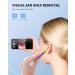 Anykit Digital Otoscope for Phone & Tablet - Ultra Clear Ear Camera & Wax Removal Tools - Video Ear Scope with Light - Capture Photos & Record Videos - Purple - Buy Online on GoSupps.com