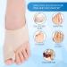 Bunion Corrector Set with Gel Pad Sleeve - Orthopedic Pain Relief for Men and Women | Toe Separator, Non-Slip Insert, Heel Band Cushions | Hammer Toe Relief, Toe Realignment - 2 Piece Set - Buy Online on GoSupps.com