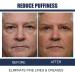 HIMSE Awaken Peptide Depuffing Eye Gel - Men's Moisturizing Eye Cream (3-Pack) - Buy Online on GoSupps.com