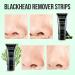 Black Head Remover Charcoal Peel Off Mask - Deep Cleansing Pore & Acne Treatment for All Skin Types - Buy Online on GoSupps.com