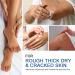 Urea Cream 45% with Salicylic Acid 2% - Intense Moisturizer for Dry Cracked Feet & Hands | Nourishing Foot Cream 1.7 fl.oz - Buy Online on GoSupps.com