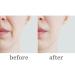 Vitality Precision Skin Retinol Pads 0.5% - 3 Month Supply for Youthful Skin | International Shipping Available - Buy Online on GoSupps.com
