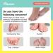 Toe Spacers & Bunion Corrector for Kids | Hammer Toe Straightener & Corn Callus Removers | Overlapping Toes Separators | Best Bunion Relief | Small Size (1 Pair - Buy Online on GoSupps.com