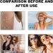 UV Sun Detection Stickers Sunblock Patches | Sunscreen Reminder Stickers Know When to Re-Apply Sunscreen Sun Patch for Sunscreen - Buy Online on GoSupps.com