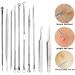 Acne Needle Pimple Blackhead Remover Tool Needles for Squeezing Tools Spoon for Face Cleaning Comedone Extractor Pore Cleaner (Color : Style 3) - Buy Online on GoSupps.com