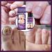 Fungal Nail Treatment 30ml Extra Strong Nail Fungus Treatment for Toenail and Fingernail Premium Fungal Nail Eliminator Anti fungus Nail Repair and Strengthen Fix & Renew Damaged Broken Nails - Buy Online on GoSupps.com