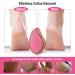 Nano Glass Heel Scraper - Foot Shower Scrubber & Dead Skin Remover | Pink Pedicure Tool for Back Arms & Legs Care - Buy Online on GoSupps.com