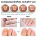Nail Care Pen - Xixiran 4 PC Nail Repair for Fungus & Well-Groomed Nails | Intensive Nail Care Sticks - Buy Online on GoSupps.com