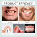 Bikenda Premium Full Set Dentures - Solution de proth se flexible de nouvelle g n ration pour hommes et femmes | Proth ses dentaires souples confortables et adapt es (1pcs) - Buy Online on GoSupps.com
