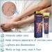 Varicose Veins Cream - Spider Veins Repair & Treatment for Legs | Relief Ointment - Buy Online on GoSupps.com