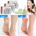 Azltdcow 100 PCS Professional Corneal Raiser & Chicken Eye Remover Files - Stainless Steel Foot Scrapers & Pedicure Tools for Fish & Feet - Buy Online on GoSupps.com
