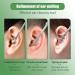 Earwax Cleaner Tool Set New Ear Cleaner Ear Pick Earwax Removal Kit Earwax Removal Tool with Portable Case Household Portable Manual Ear Wax Removal Kit (Yellow) - Buy Online on GoSupps.com