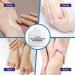 42% Urea Cream for Feet - Callus Remover for Feet - Foot Cream for Dry Cracked Heels and Feet - Urea Foot Cream - Soften Skin Texture & Gently Exfoliating - Foot Care - Foot Cream for Very Dry Feet - Buy Online on GoSupps.com
