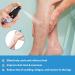 3Pcs Varicose Veins Treatment Set - Heal Veins, Improve Circulation - 90ml Spray - Buy Online on GoSupps.com