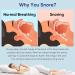 Memonotry Snoring Aid Mouthpiece - Shapeable Anti-Snoring Device for Men/Women - Stop Snoring Comfortably - 1PCS - Buy Online on GoSupps.com