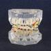 Fydun Dental Orthodontic Tooth Model for Malocclusion Treatment | International Shipping Available - Buy Online on GoSupps.com