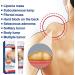 Lipoma Elimination Cream Cr me D' limination des Lipomes V g taux Lipoma Relieving Cream Facile Utiliser par Une Personne la Maison Aussi - Buy Online on GoSupps.com