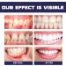 Koahde Gums Gel - Instant Gum Treatment & Therapy Gel | 2PC Gum Repair & Tooth Care Solution - Buy Online on GoSupps.com