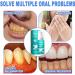 Smile Bright Mouthwash - Smartsmile Tooth Whitening & Rebuilding (3PCs) | International Shipping Available - Buy Online on GoSupps.com