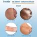 Evolsin Transparent Scar Patches - Silicone Scar Treatment for All Scars (200 cm) | Reduce & Heal Effectively - Buy Online on GoSupps.com