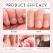 Anti Nail Biting Nail Polish - Stop Nail Repair Nail Varnish - Stop Biting Your Nails - Nail Biting Prevention - Clear Nail Varnish Discourages Nail Biting & Thumb Sucking For Children & Adults - 10ml - Buy Online on GoSupps.com