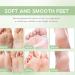 Tea Tree Oil Foot Cream Foot Balm for Cracked Dry Feet Athletes Foot Nail Fungus Hydrates and Moisturizes Callused Feet - Heel Cream All Natural Foot Cream Hand Cream - Helps Soothe Irritated Skin - Buy Online on GoSupps.com