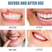 Spray de R paration des Gencives Pr venir le Saignement 20ML 1PC(Soulagement Soulager les Gencives D garnies Rem des pour les Dents et les Gencives) - Buy Online on GoSupps.com