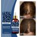 Rubu22a Rosemary oil blueberry hair oil suitable for women and men pure natural cosmetics for hair and scalp nourishing scalp treatment 100 ml 033 ml 300er Pack - Buy Online on GoSupps.com