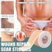 Professional Silicone Scar Sheets Roll - 1.6 X 60 Inch - Soft Gel for Scars - Surgical, C-Section, Keloid, Acne - Effective Scar Removal Treatment - Buy Online on GoSupps.com