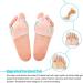 Metatarsal Pads Bunion Corrector with Gel Toe Separator - Forefoot Cushion for Callus, Pedicure & Yoga - Buy Online on GoSupps.com