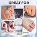 Marie Originals Bioactive Barrier Ointment | Plant-Powered Jock Itch Ringworm & Fungus Relief | Fast Recovery Solution - 1oz - Buy Online on GoSupps.com