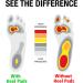 Plantar Fasciitis Heel Cup for Women and Men - Max Shock Absorption Inserts for Heel, Knee, and Back Pain Relief (Yellow Pad) - Size W 6-11.5 / M 4.5-9.5 - Color 1 - Buy Online on GoSupps.com