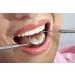 1 Dentist Tools Kit - Premium Stainless Steel Dental Hygiene Set with Tartar Remover Picks Scrapers & Free Case - Ideal for Professional & Home Use - Buy Online on GoSupps.com