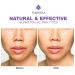 Dark Spot Remover Serum for Face & Body | Age Sun Spots, Freckles, Melasma Treatment | 4-Butylresorcinol, Kojic Acid, Hyaluronic Acid - 50ml - Buy Online on GoSupps.com