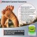 Nail Fungus Laser Treatment Device - Home Treatment for Healthy Nails and Toenails (White) - Buy Online on GoSupps.com