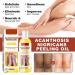 Extra Strong Peeling Oil - Chemical Exfoliant for Face & Body | Reduces Wrinkles Stretch Marks & Dead Skin - Buy Online on GoSupps.com