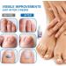 Fungal Nail Treatment - Fungal Nail Treatment for Toenails Extra Strong - Anti Fungus Nail Repair and Strengthen - Toenail Fungus Treatment for Thickening Yellow-Brown Discoloration Ragginess 20ML - Buy Online on GoSupps.com