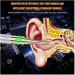 NAUTIG Visual Ear Picking Tool with 1080P Camera for Ear Wax Removal - Buy Online on GoSupps.com